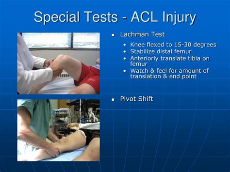 special test for acl tear